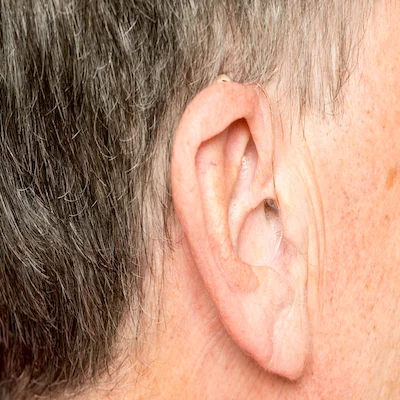 HearingAids LeadImage 17